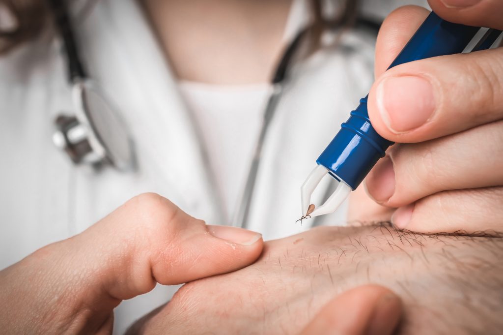 Doctor removing a tick with tweezers from hand of patient